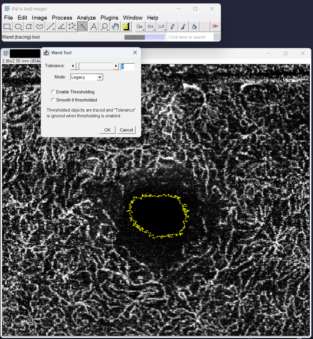 imagej_step