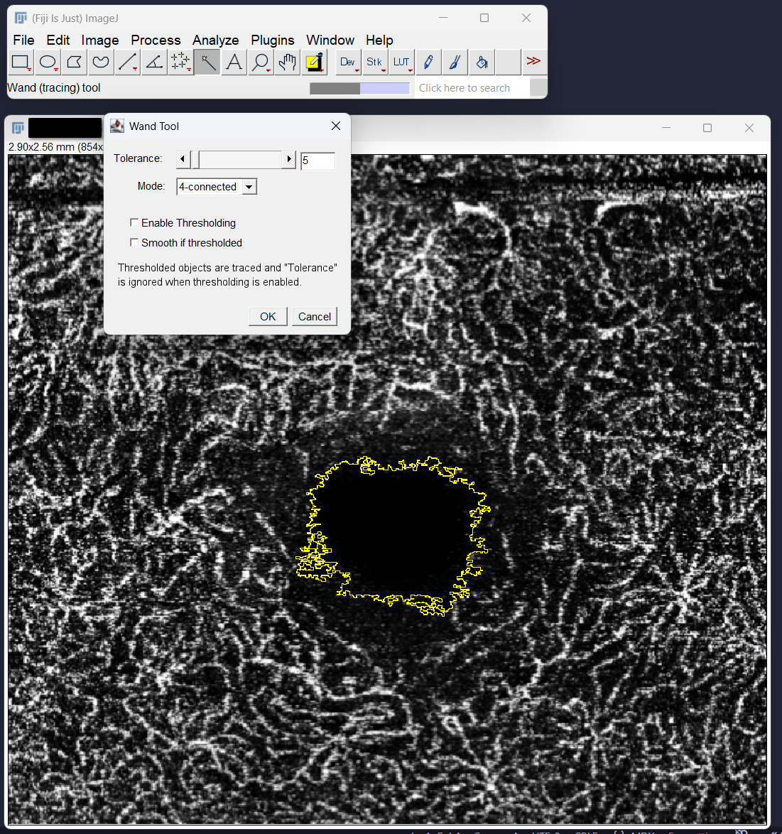 imagej_step